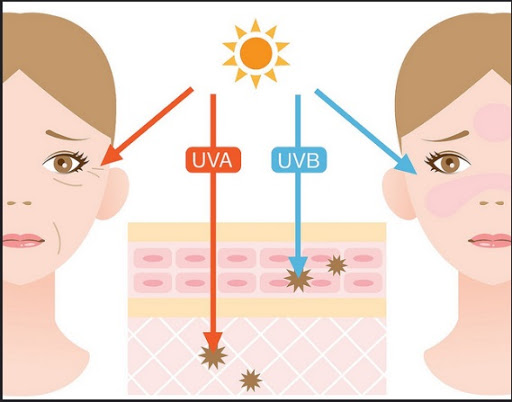 Tác hại của tia UVB và UVA đến làn da 